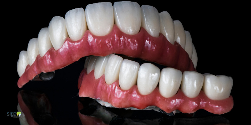 O que é Protocolo Dentário?