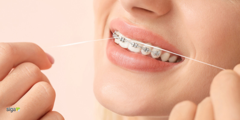 Como usar o Fio Dental com Aparelho para uma higiene oral completa